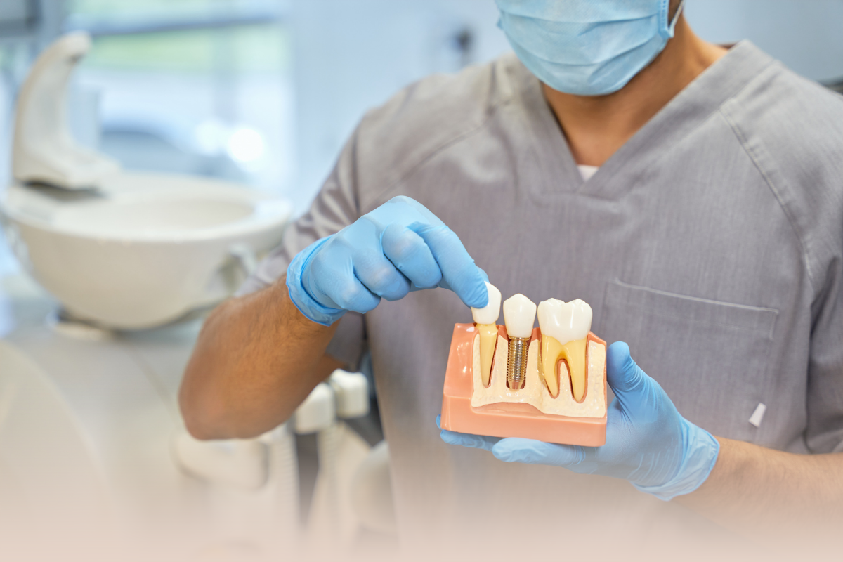 علاجات زراعة الأسنانnde Son Teknoloji Nedir?