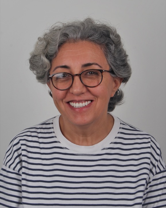 Our completely edentulous patient was given implants and All on Six treatment. Thanks to the zirconium prostheses on implants, she can smile with confidence.