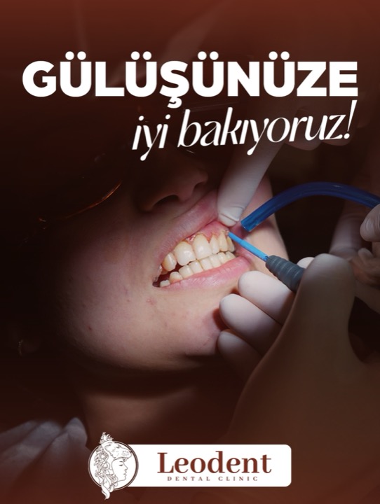 Gülüş, sadece estetik değil; aynı zamanda ağız ve diş sağlığının bir yansımasıdır.
Düzenli kontroller ve doğru bakım, diş etlerinin ve dişlerin uzun vadede sağlıklı kalmasına yardımcı olur.
Küçük dokunuşlar, büyük farklar yaratabilir.
Detaylı bilgi ve randevu için:
📞 (216) 766 15 36
📱 0532 652 47 67
Her tedavinin süreci ve sonucu kişiden kişiye değişebilir. Tedavi öncesinde hekiminizden detaylı bilgi almanız önerilir.
#AğızDişSağlığı #DişKontrolü #SağlıklıGülüş #LeodentDentalClinic